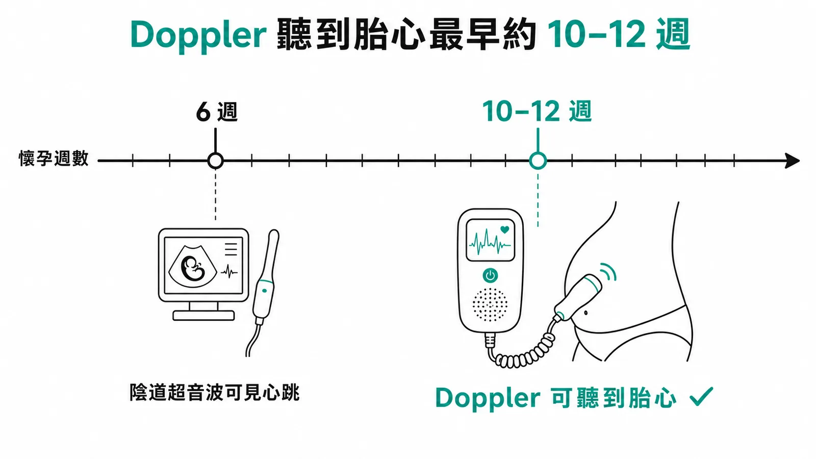Doppler胎心音監測器最早約10-12週可聽到胎兒心跳