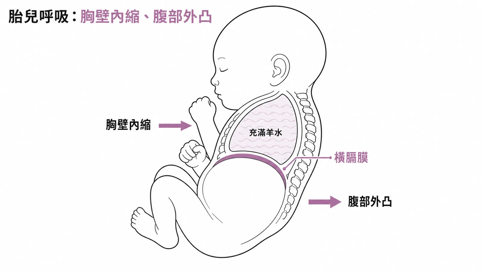 胎兒呼吸運動示意:肺內充滿羊水,胸壁內縮、腹部外凸