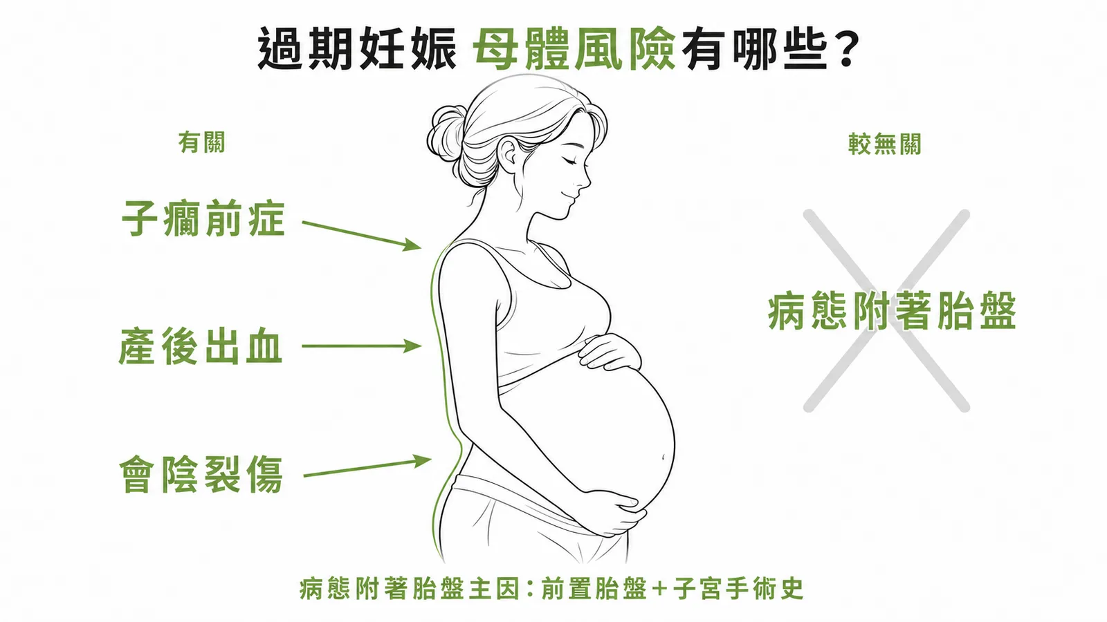 過期妊娠母體風險對比:子癇前症、產後出血、會陰裂傷有關,病態附著胎盤較無關