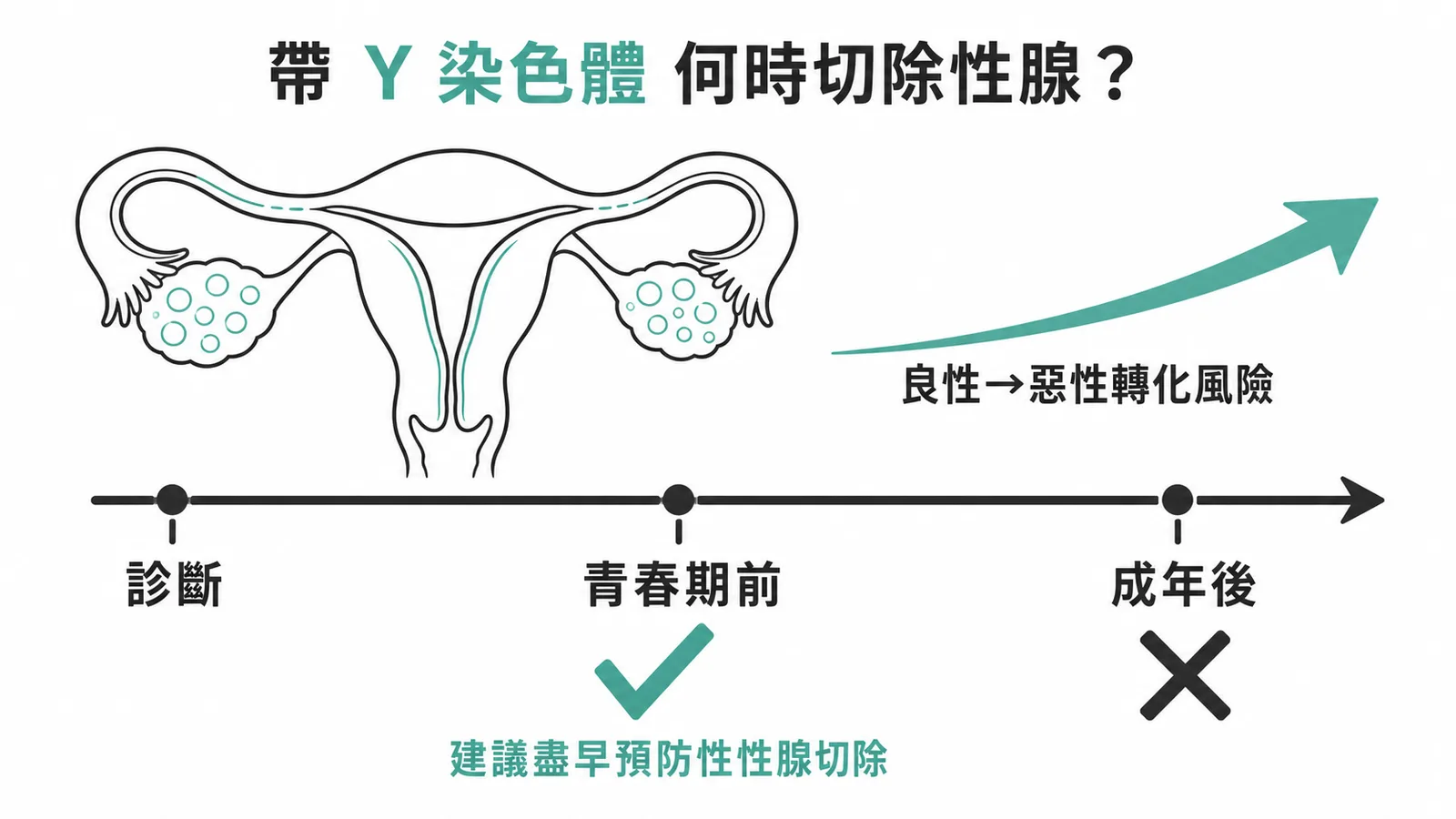 帶Y染色體Turner syndrome應在青春期前盡早預防性性腺切除
