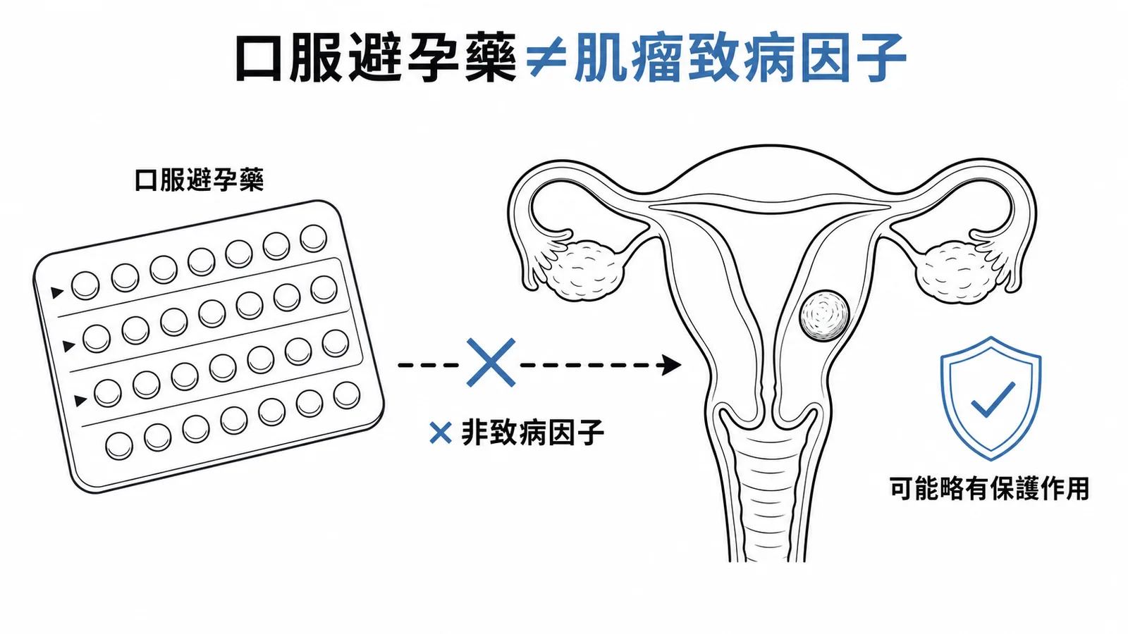 口服避孕藥並非子宮肌瘤致病因子,可能略有保護作用