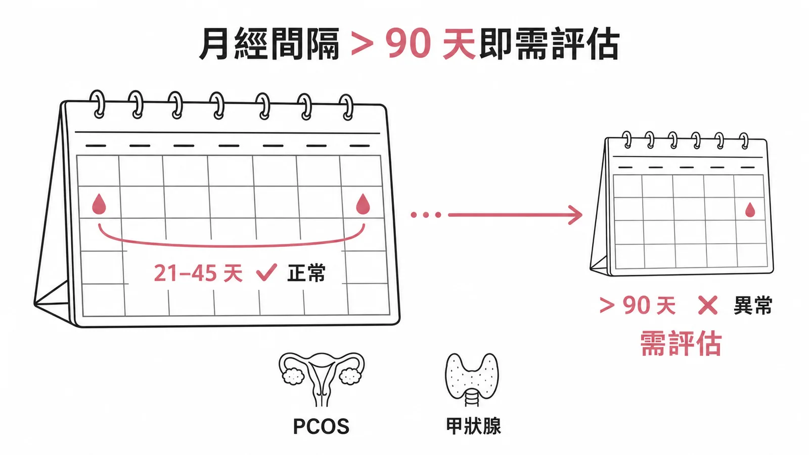 青春期月經間隔超過 90 天即異常,需排除 PCOS 與甲狀腺問題