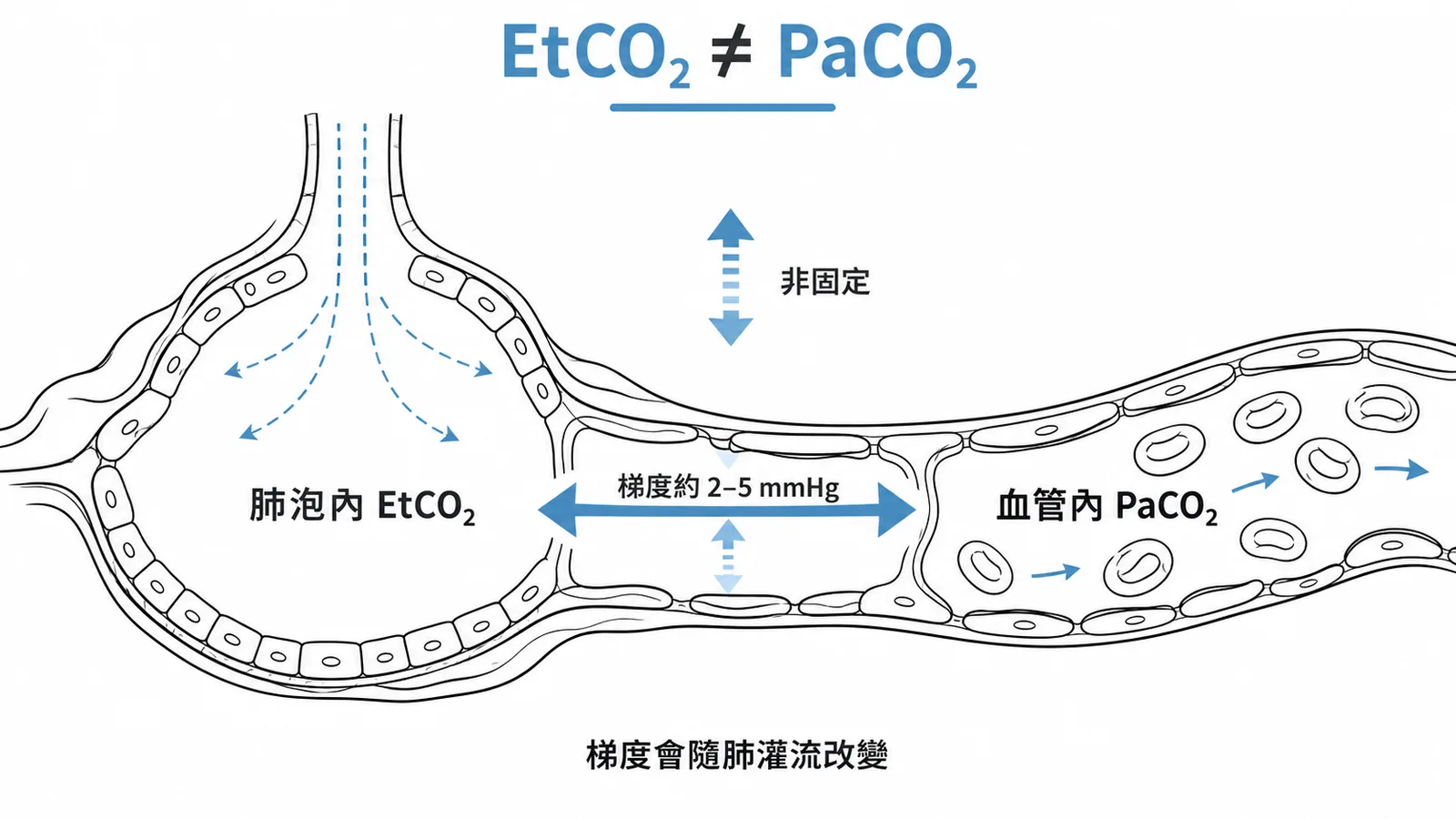 EtCO2 與 PaCO2 梯度非固定，會隨肺灌流改變