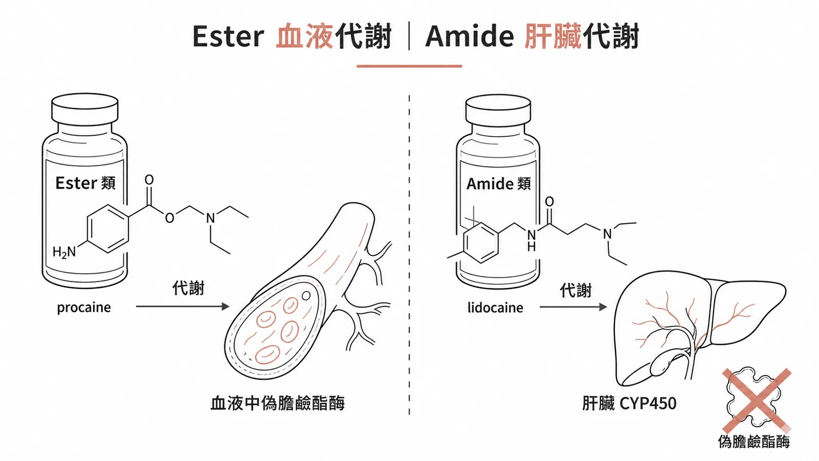 Ester 類經血液偽膽鹼酯酶代謝，Amide 類經肝臟 CYP450 代謝