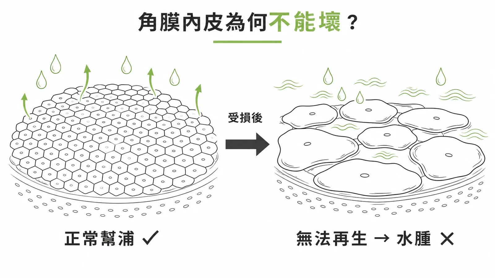 角膜內皮細胞受損後無法再生只能靠周圍細胞擴大彌補的對照圖