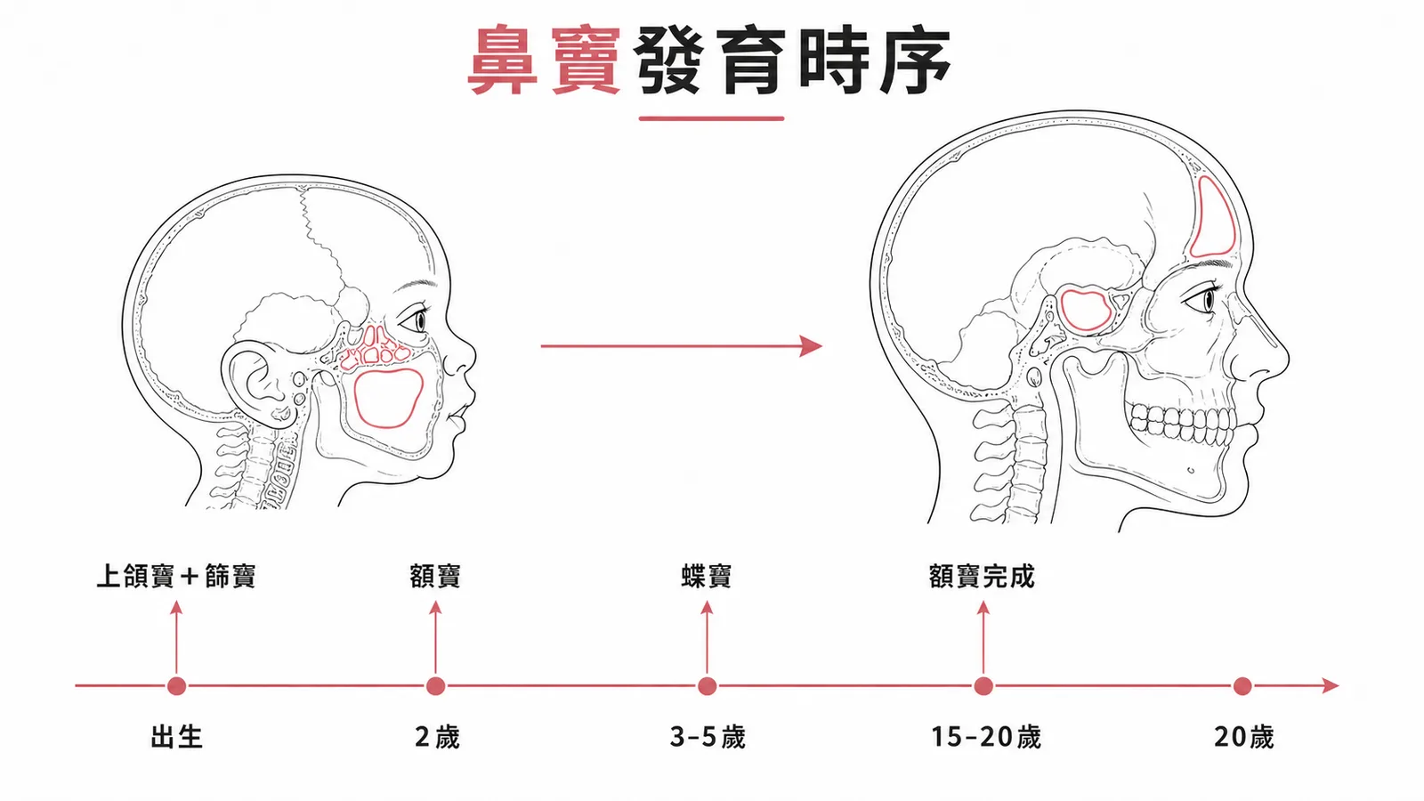 鼻竇發育時序:上頜竇篩竇出生即有,額竇2歲,蝶竇3-5歲,額竇15-20歲完成