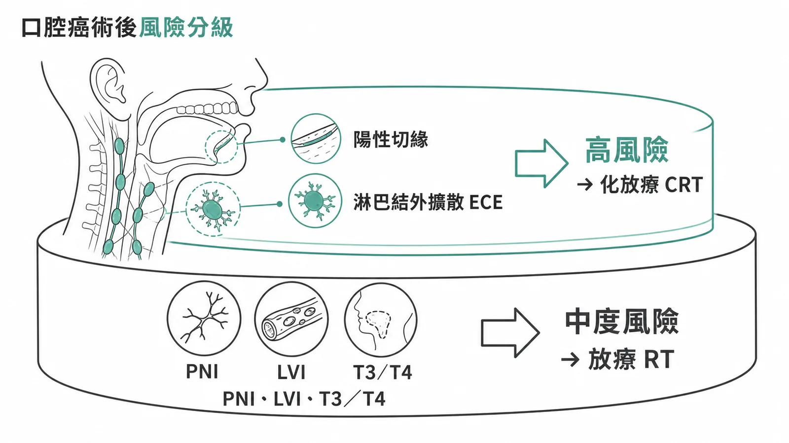 口腔癌術後風險分級:高風險陽性切緣與ECE需化放療,中度風險PNI LVI T3T4需放療