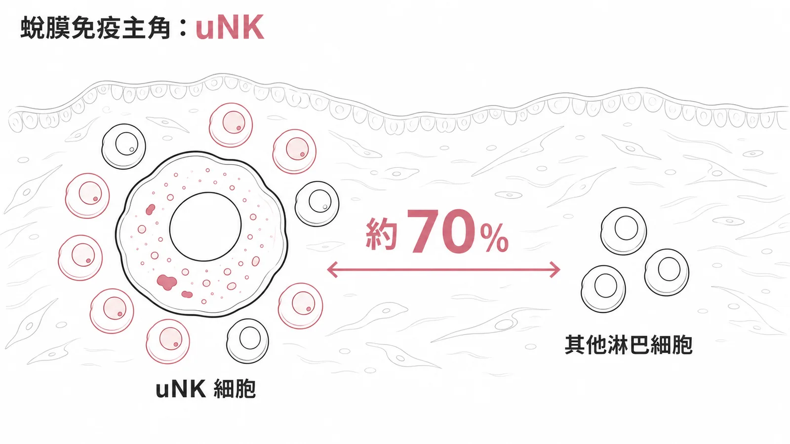 蛻膜中uNK細胞佔淋巴細胞約70%示意圖