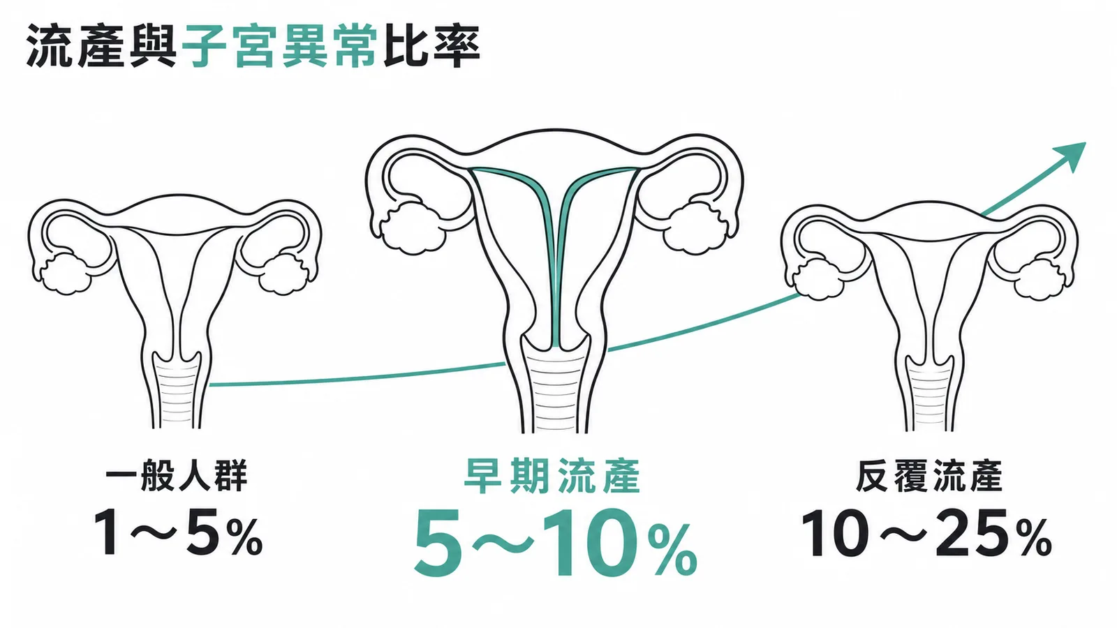 早期流產孕婦中先天性子宮異常盛行率約百分之五到十