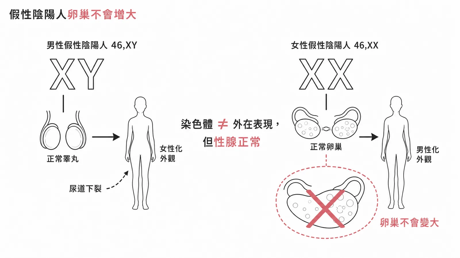 假性陰陽人性腺與染色體一致但外生殖器不同,女性假性陰陽人卵巢不會增大
