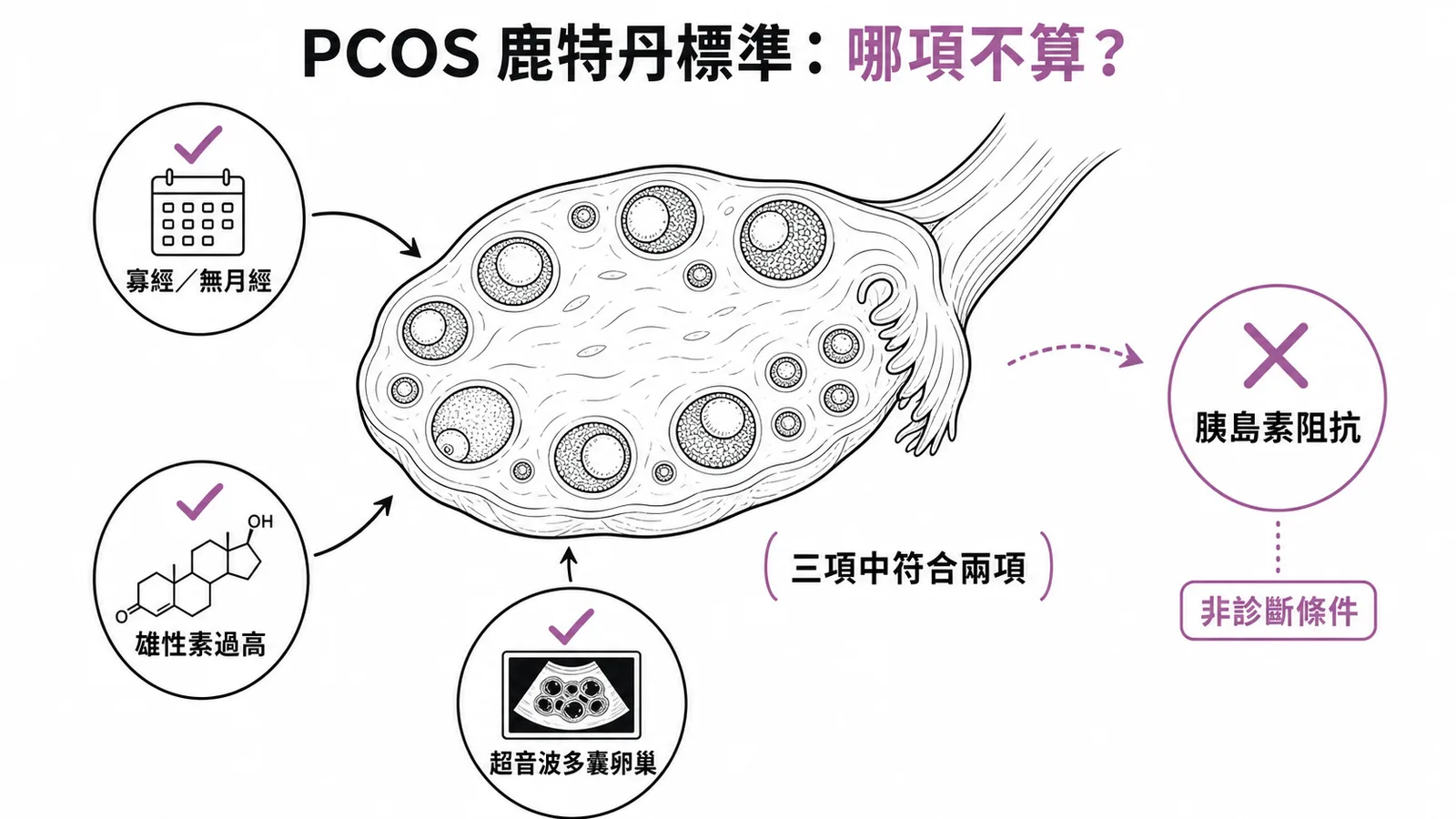 PCOS 鹿特丹診斷標準三項中符合兩項,胰島素阻抗非診斷條件