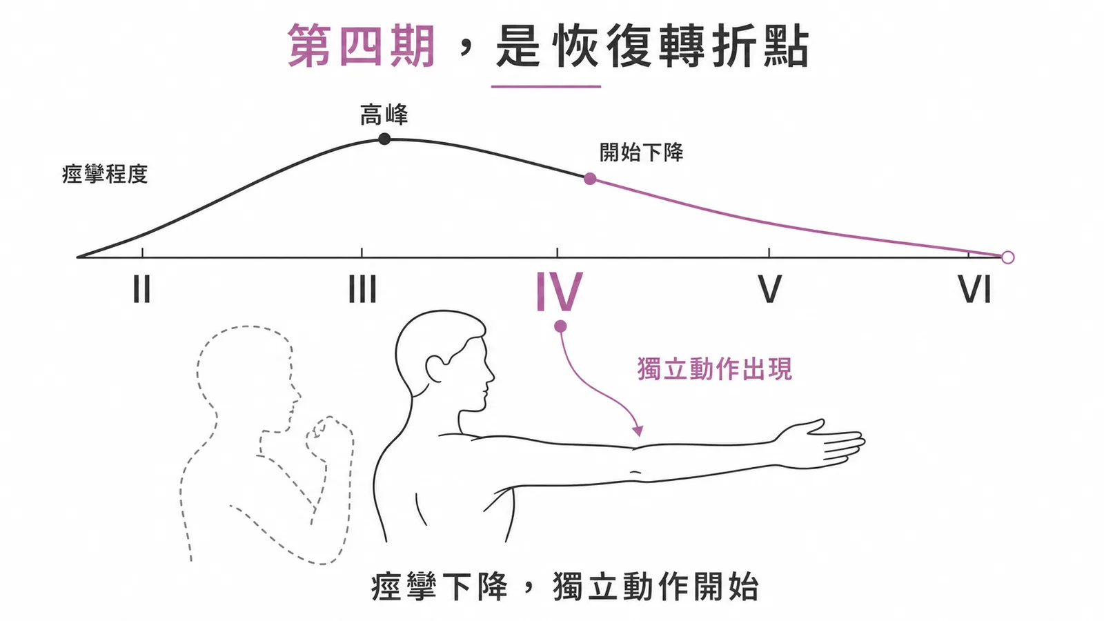 Brunnstrom 分期 Stage IV 是恢復轉折點：痙攣開始下降、獨立動作出現