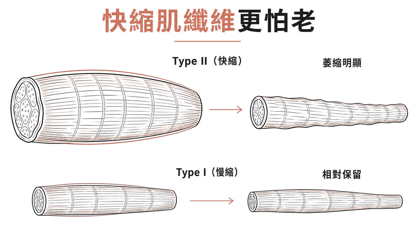 老化時第二型快縮肌纖維萎縮遠比第一型慢縮肌明顯