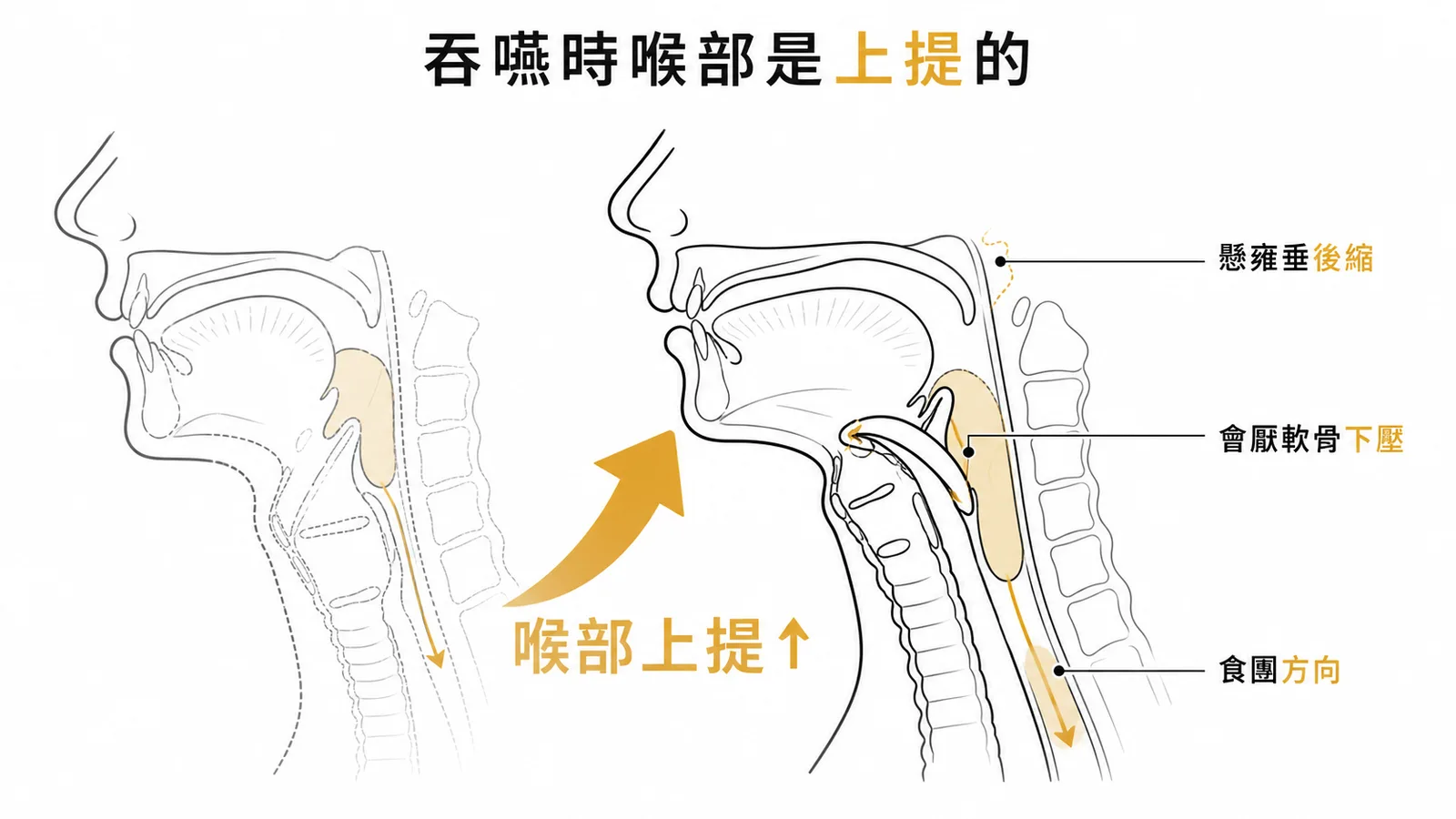 吞嚥咽部期喉部上提並前移保護氣道的矢狀面示意圖