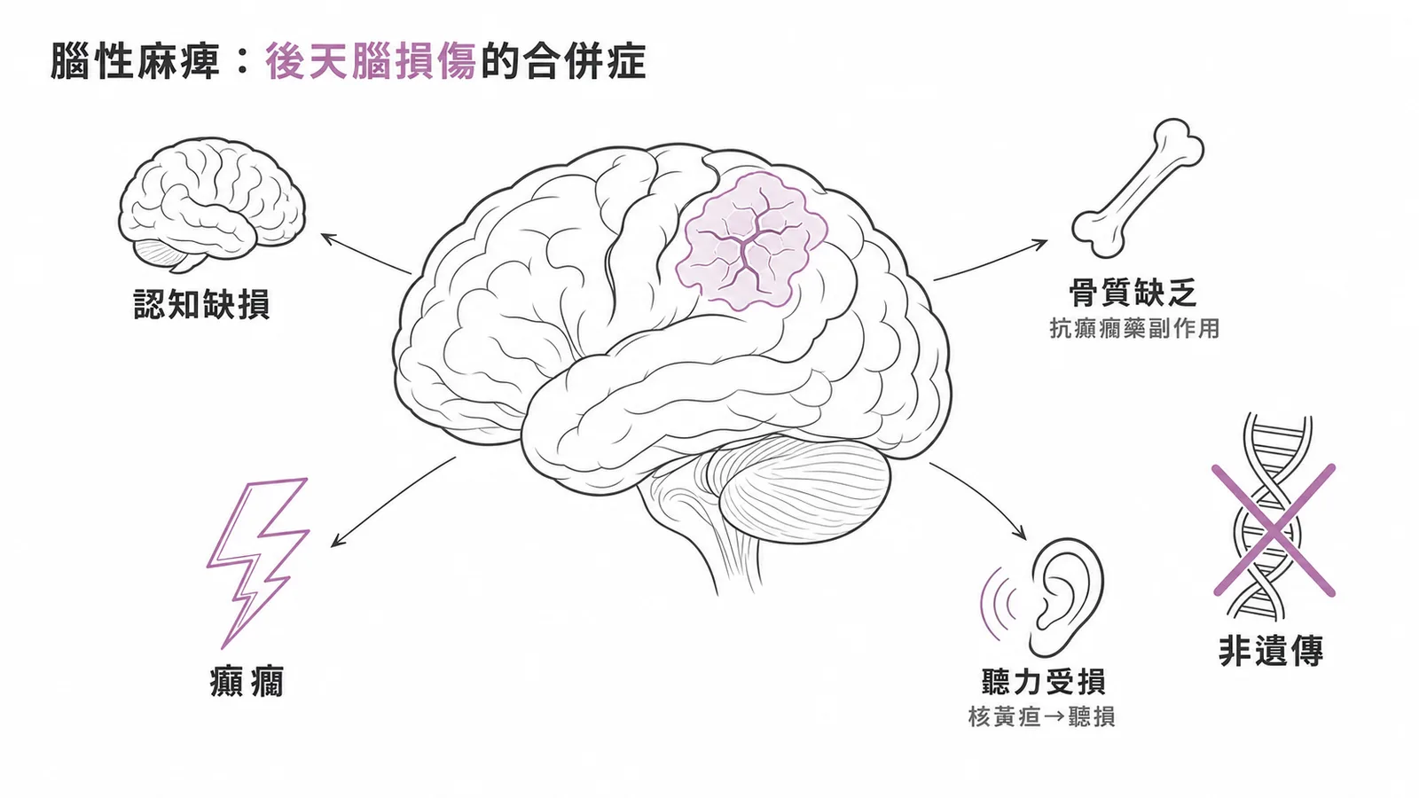 腦性麻痺是後天腦損傷所致，常見合併症包括認知缺損、癲癇、聽力受損、骨質缺乏