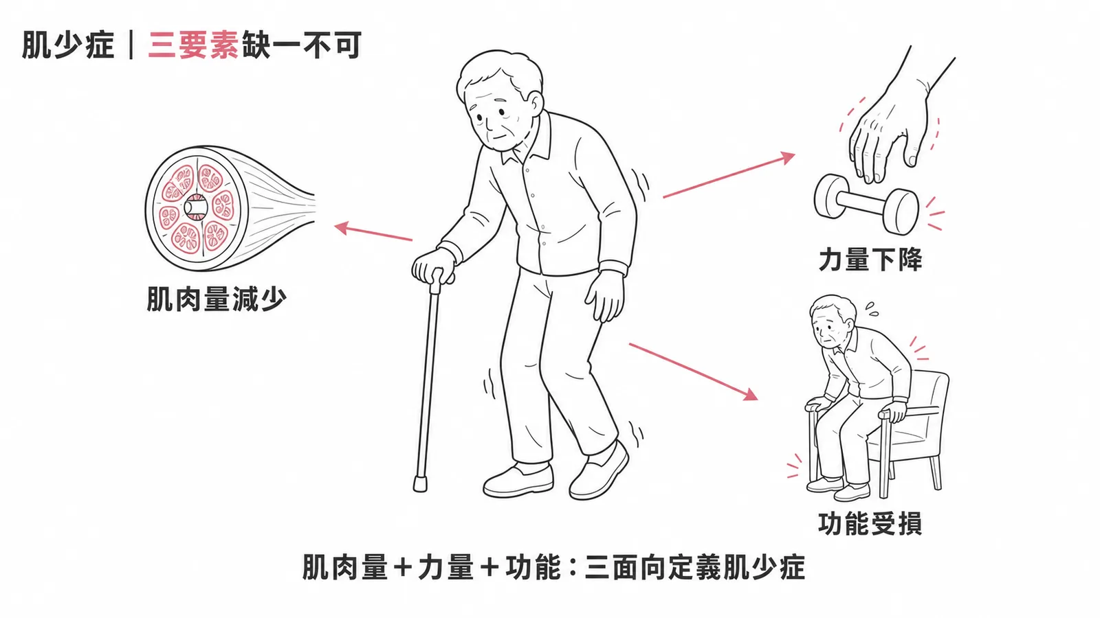 肌少症三要素：肌肉量減少、力量下降、活動功能受損