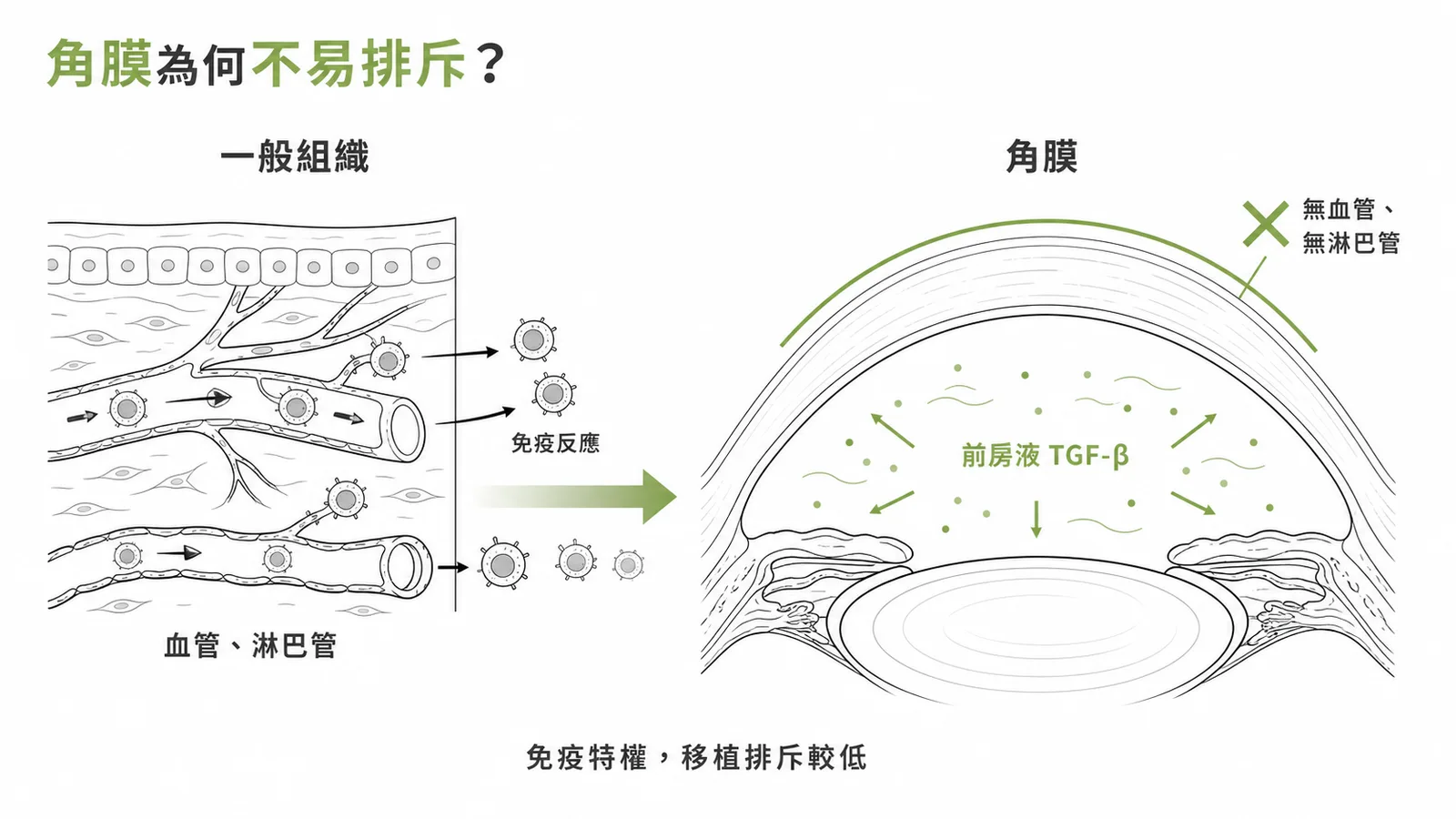 角膜無血管無淋巴管加上前房液免疫抑制因子，構成免疫特權區