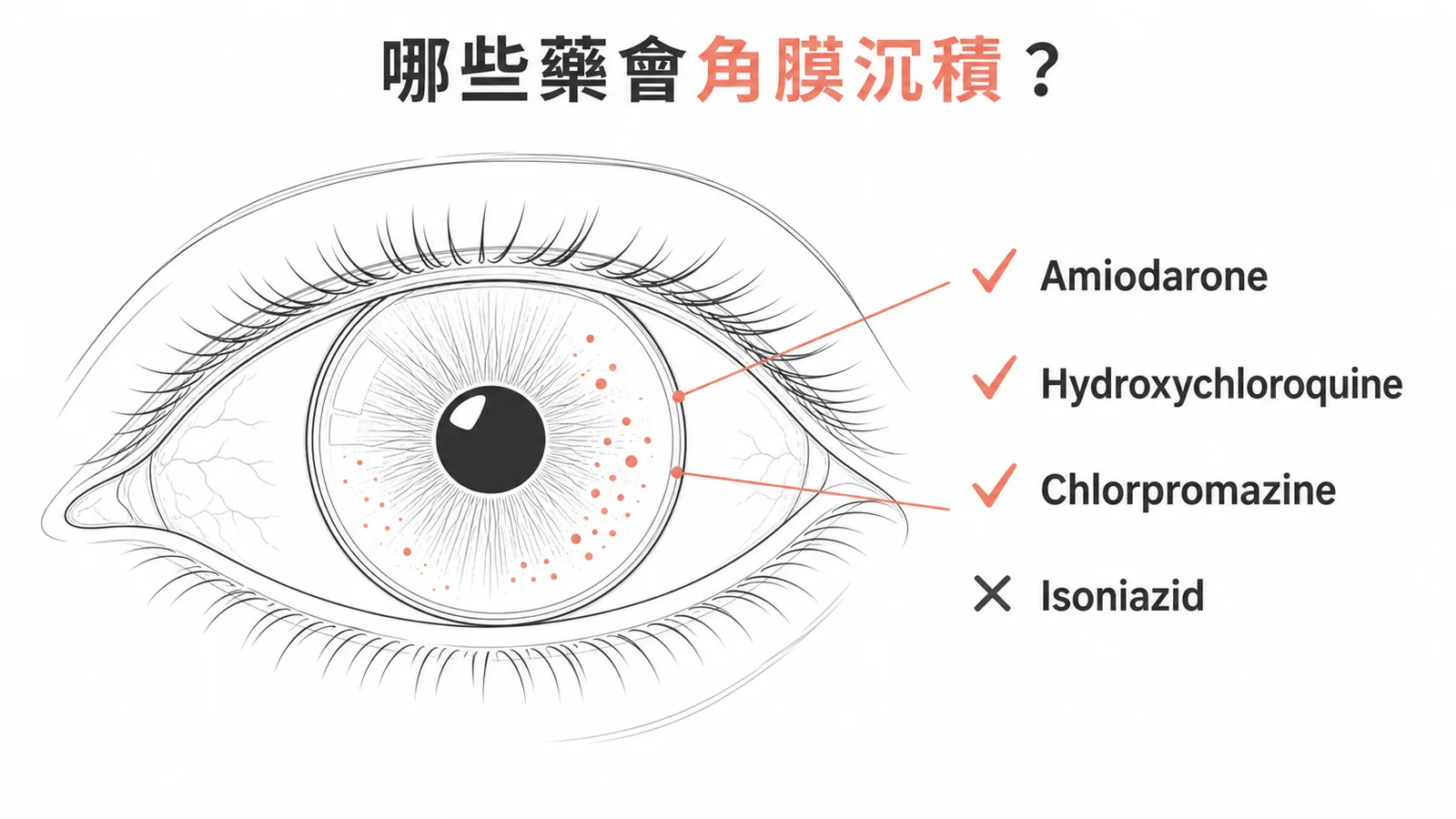 哪些藥會角膜沉積：Amiodarone、Hydroxychloroquine、Chlorpromazine 會，Isoniazid 不會