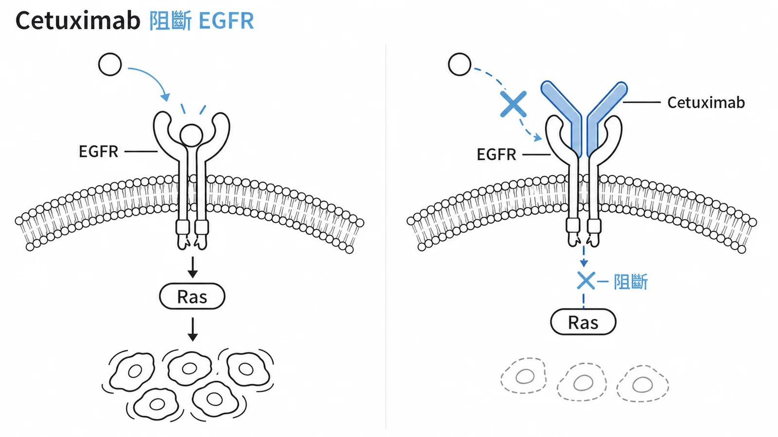 Cetuximab結合EGFR阻斷下游Ras訊號抑制癌細胞增殖