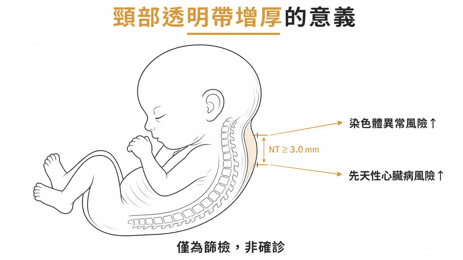 頸部透明帶增厚為染色體異常與先天性心臟病的篩檢指標