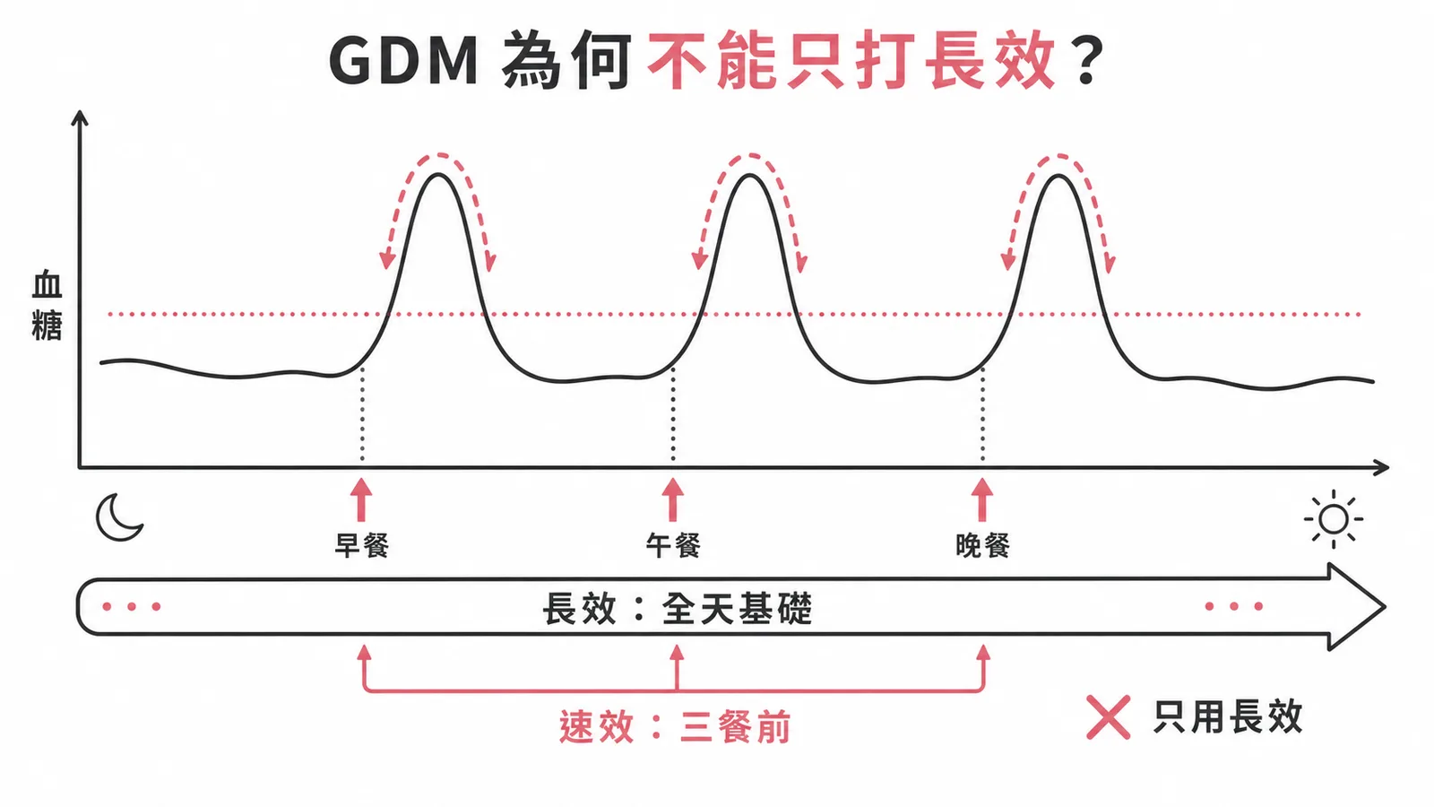 妊娠糖尿病需合併基礎與餐前胰島素的血糖曲線示意圖