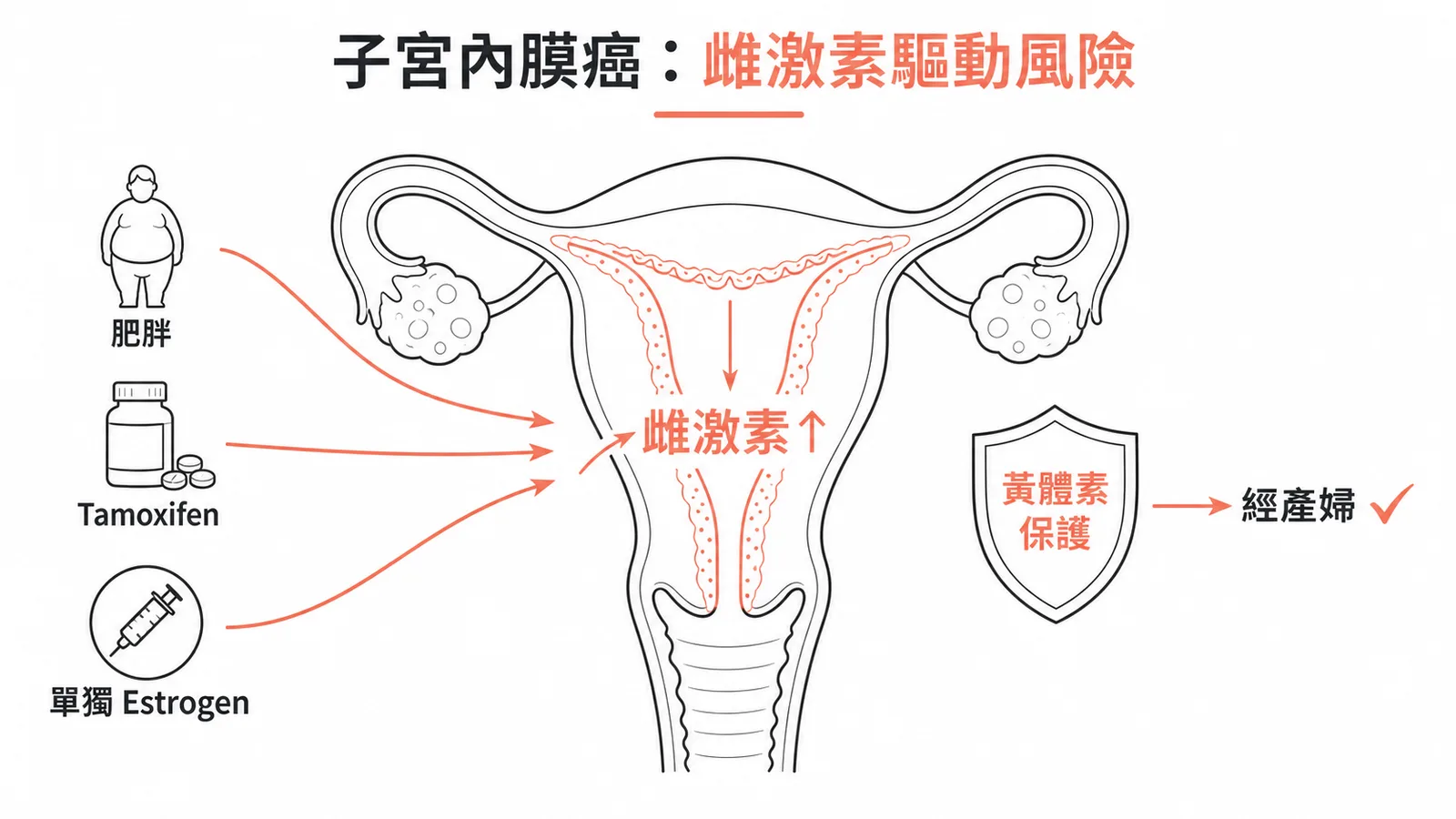 子宮內膜癌危險因子由雌激素驅動，黃體素（經產婦）有保護作用