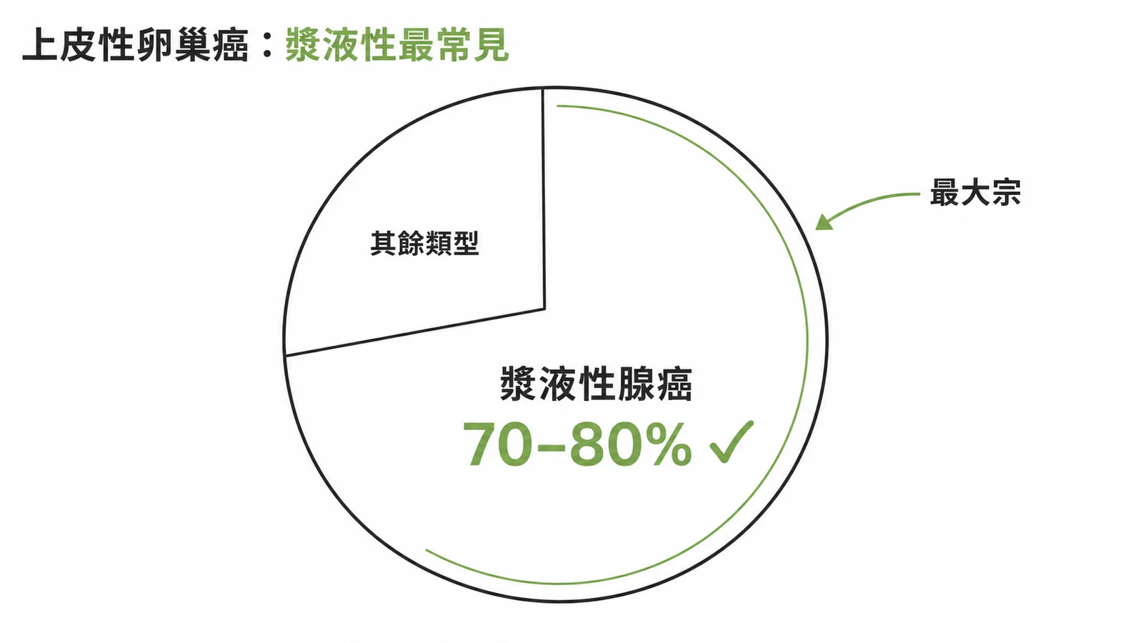 上皮性卵巢癌中漿液性腺癌佔 70-80%，為最常見的組織學類型