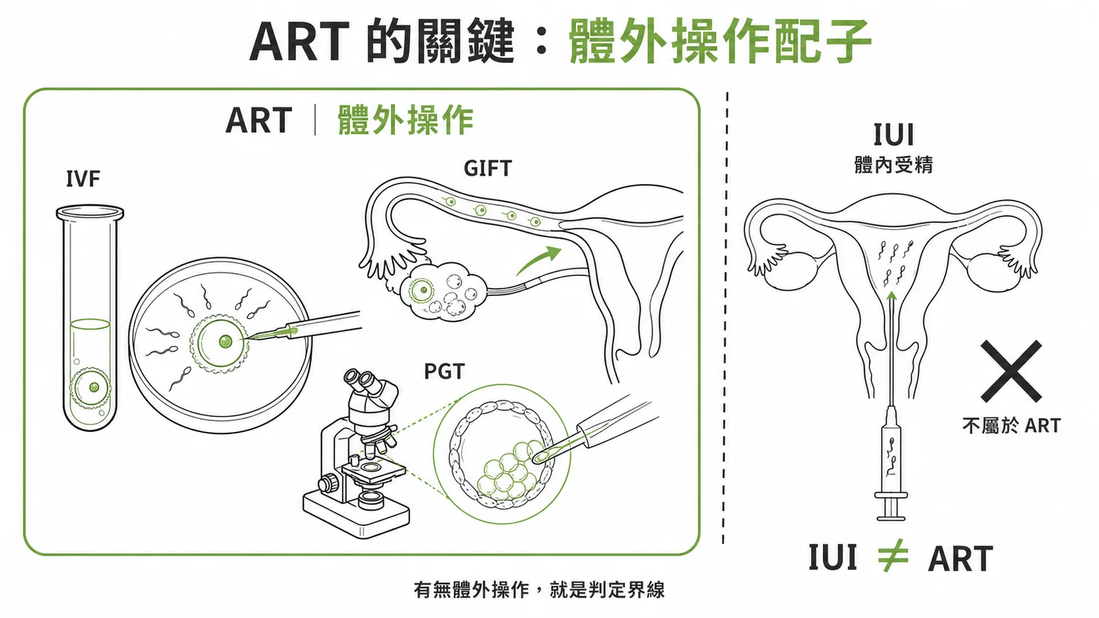 ART 的關鍵在於體外操作配子或胚胎，IUI 為體內受精不屬於 ART
