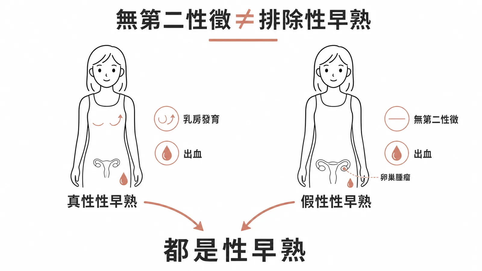 無第二性徵不等於排除性早熟，假性性早熟如卵巢腫瘤可只有出血