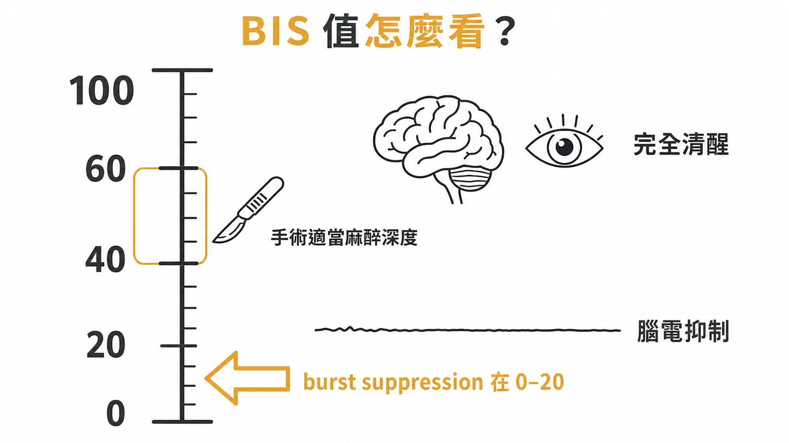BIS 麻醉深度監測數值分級：100 清醒、40-60 手術麻醉、0-20 腦電抑制