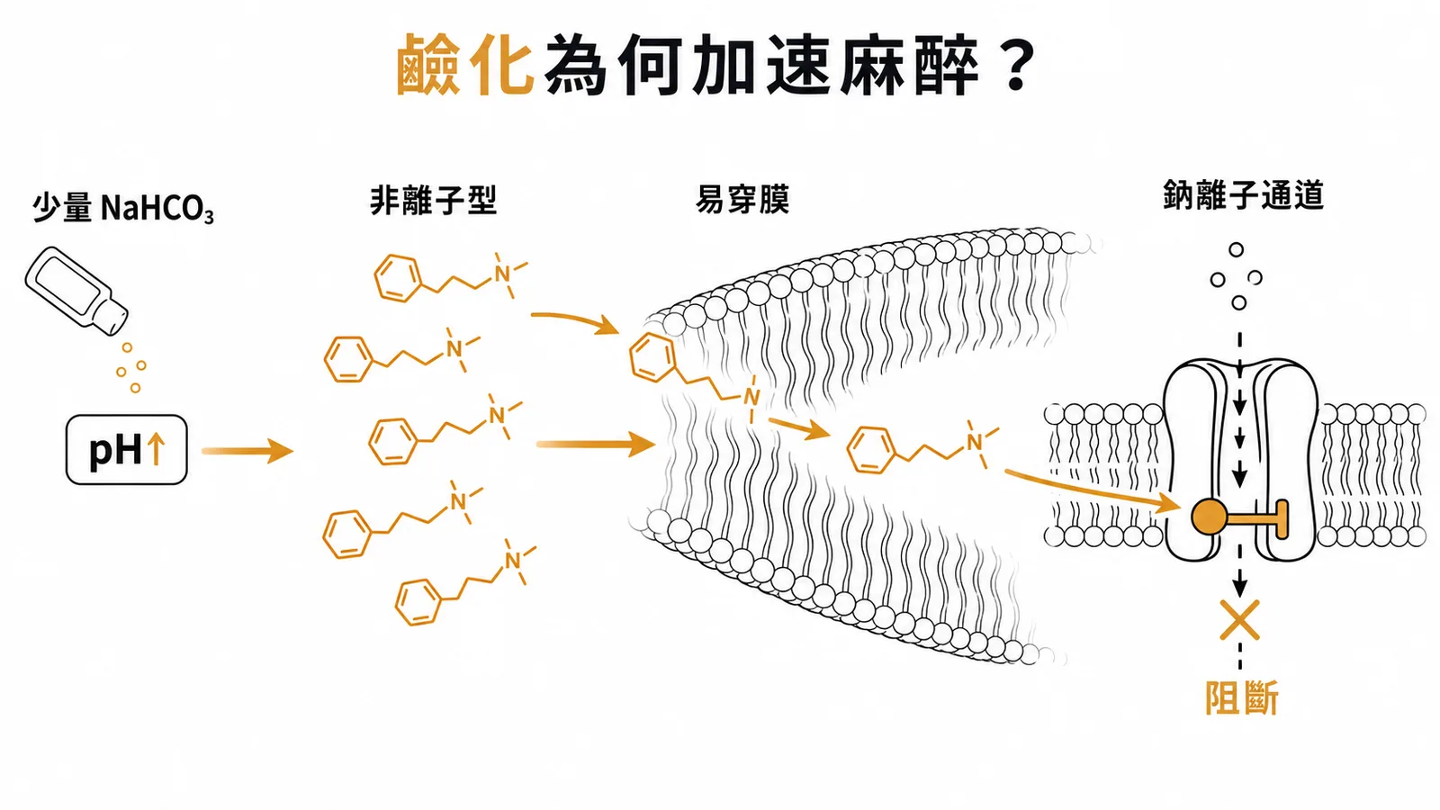 鹼化局部麻醉劑加速藥效原理：NaHCO₃ 提高 pH 增加非離子化比例，穿透神經膜阻斷鈉離子通道