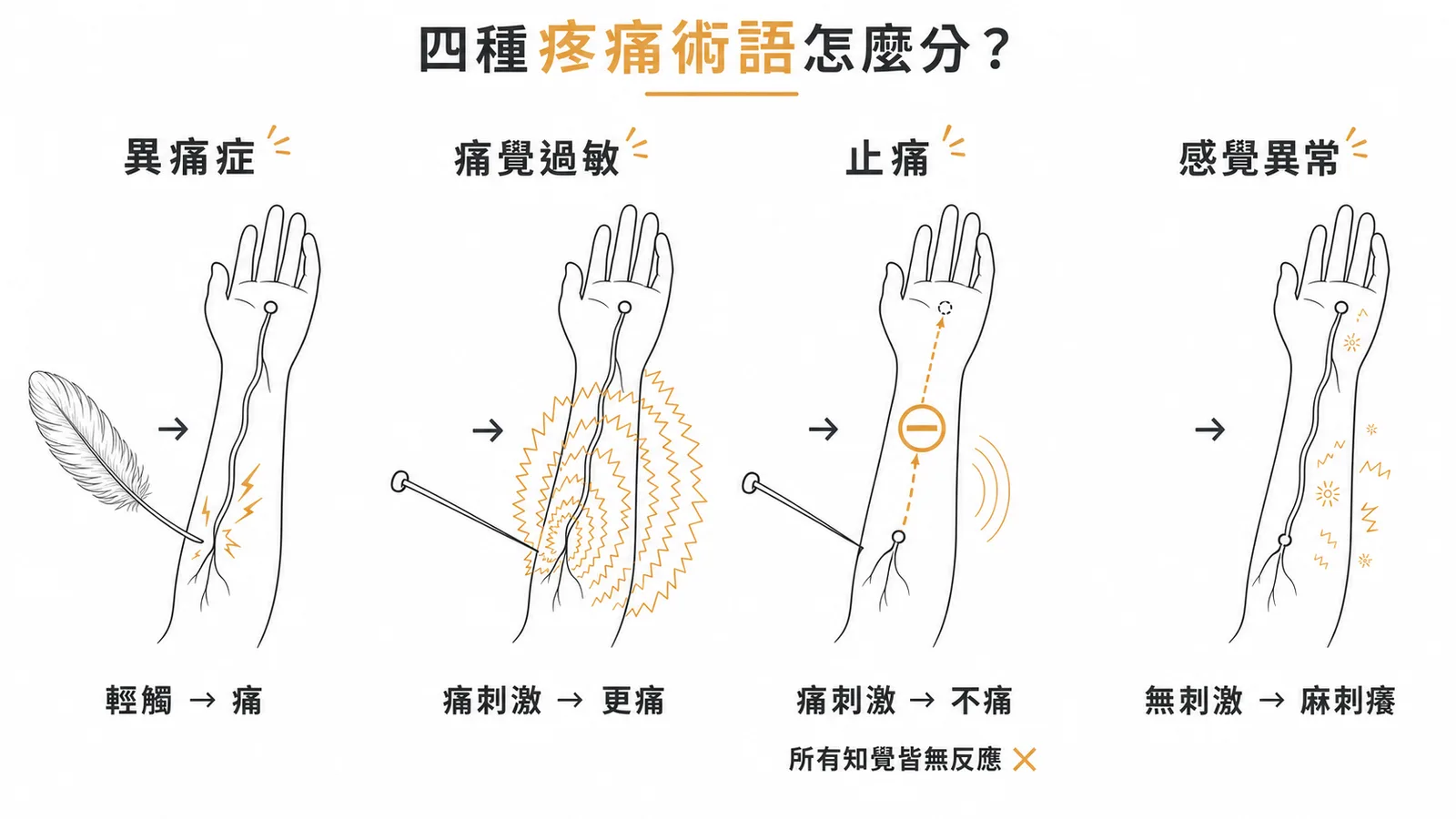 四種疼痛術語對照：異痛症、痛覺過敏、止痛、感覺異常的刺激與反應差異
