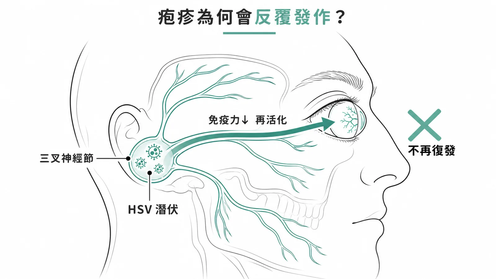 HSV 潛伏於三叉神經節，免疫力下降時沿神經再活化至眼部造成反覆感染