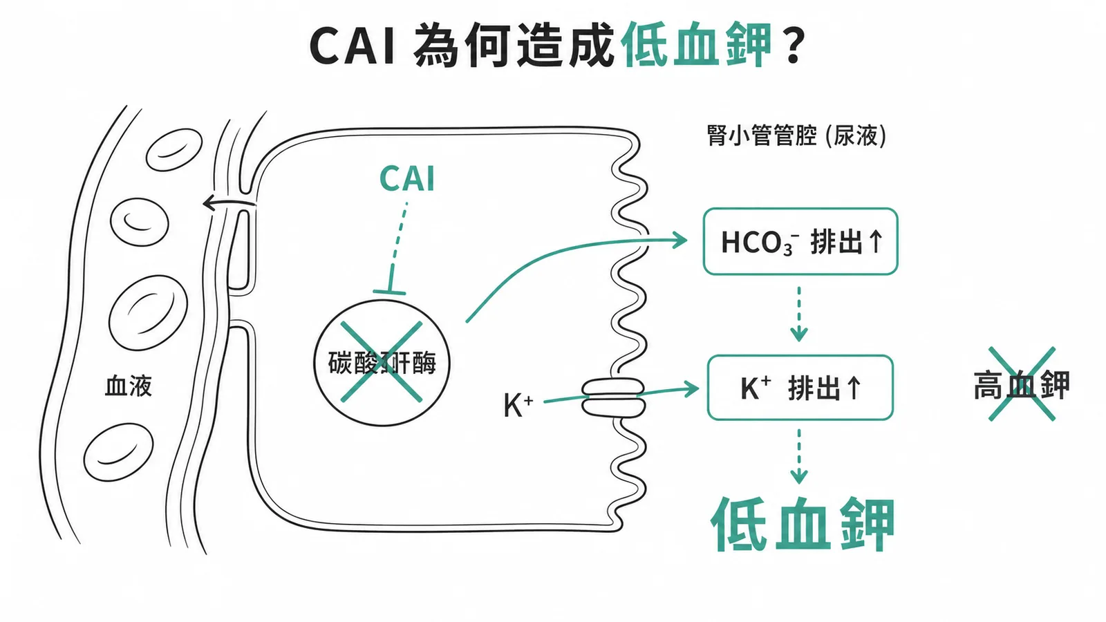 CAI 造成低血鉀機轉：抑制腎小管碳酸酐酶→HCO₃⁻ 排出↑→K⁺ 排出↑→低血鉀