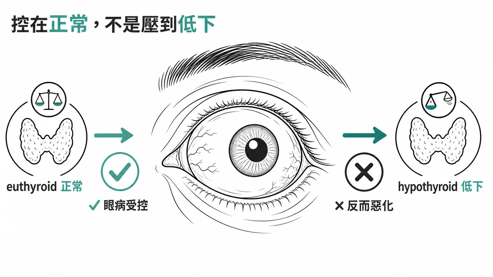 甲狀腺眼病變治療目標：控在正常而非壓到低下