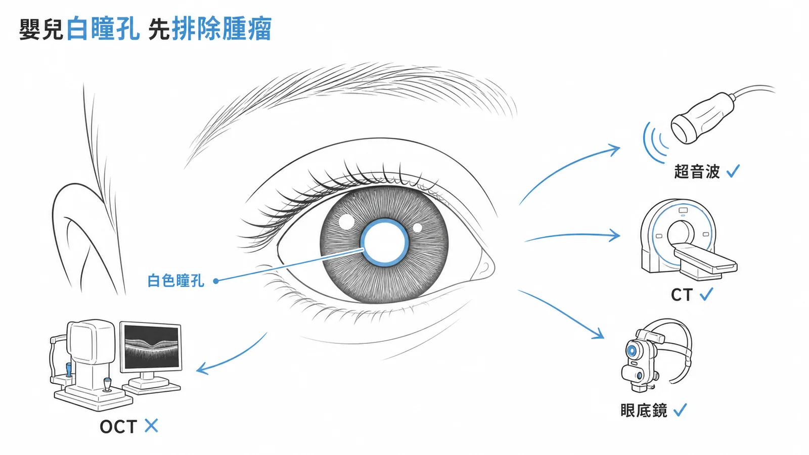 嬰兒白色瞳孔反光：首要檢查與最不需要的檢查