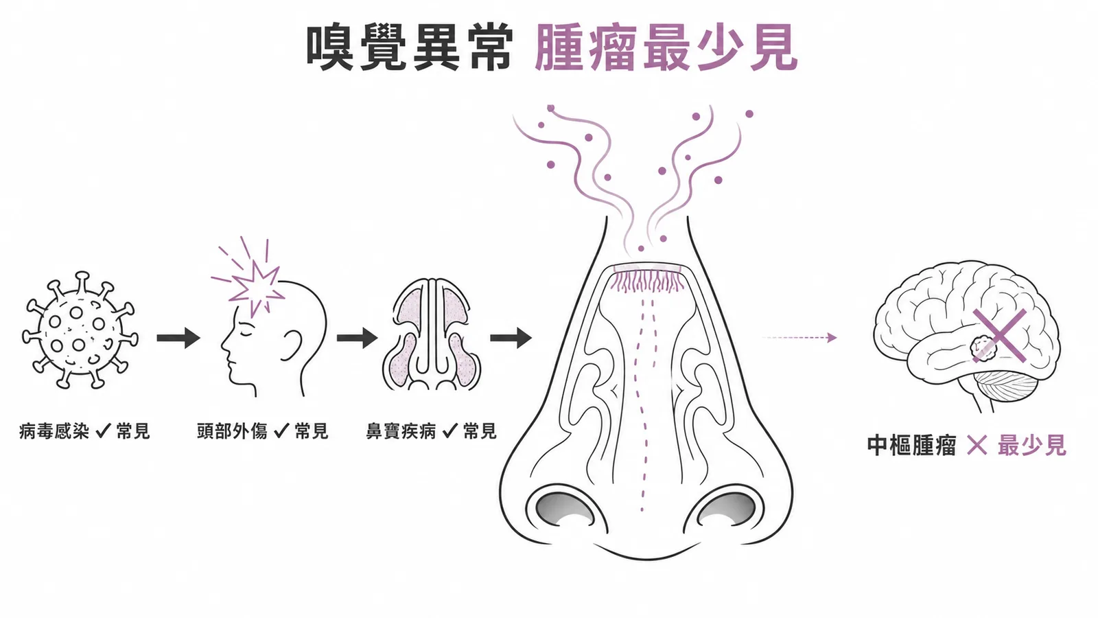 嗅覺異常原因排序:病毒感染最常見,中樞腫瘤最少見