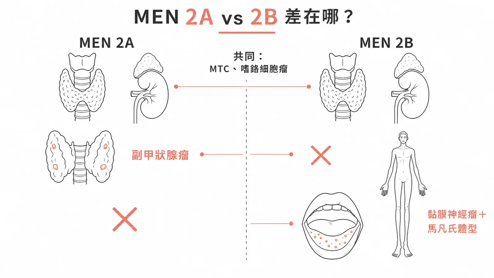 MEN 2A與2B差異對照圖