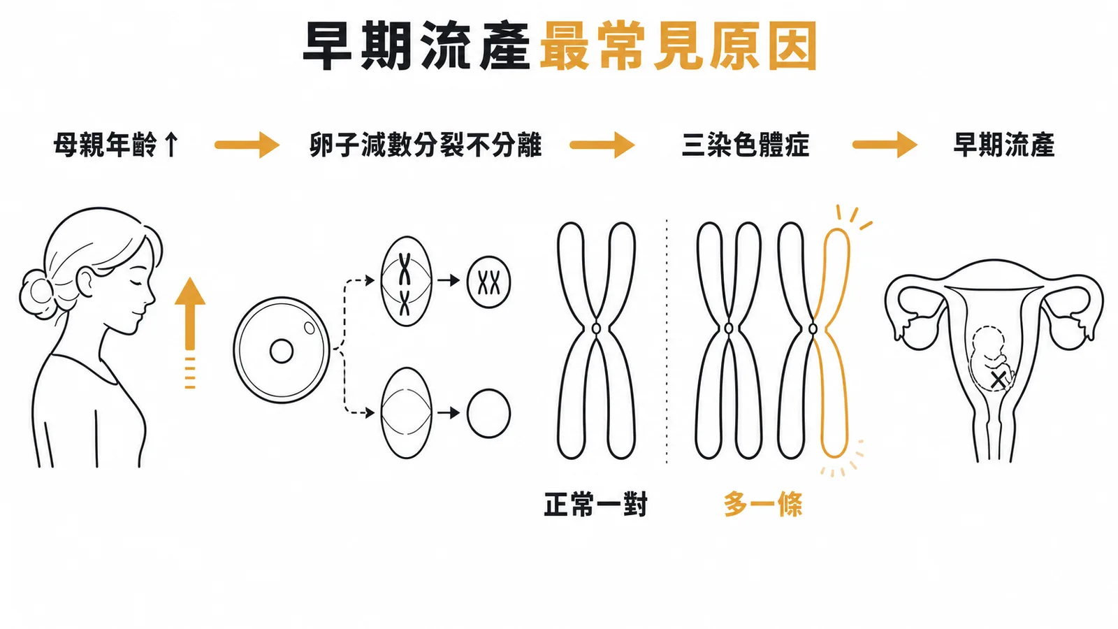 母親年齡與三染色體症導致早期流產的因果流程圖