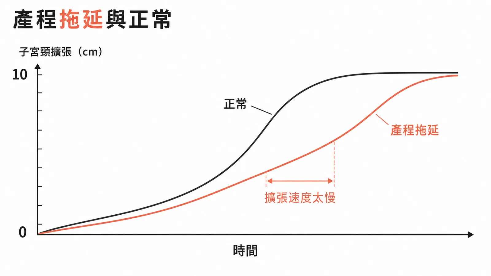 產程拖延與正常產程曲線對照圖
