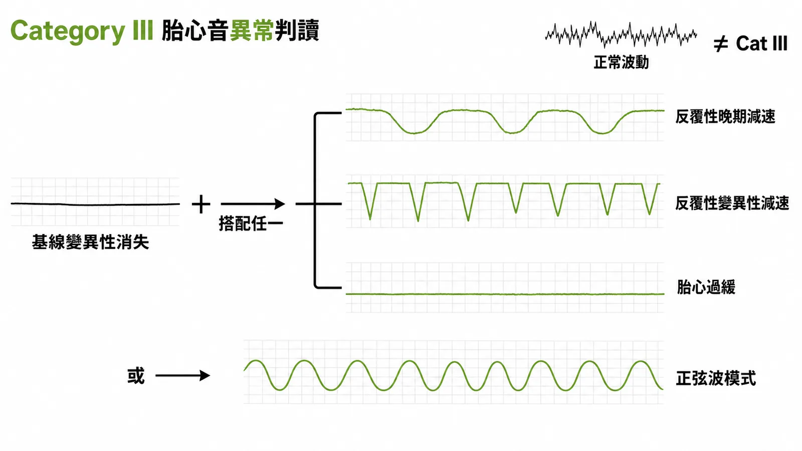 Category III 胎心音異常判讀：基線變異性消失搭配減速或正弦波模式