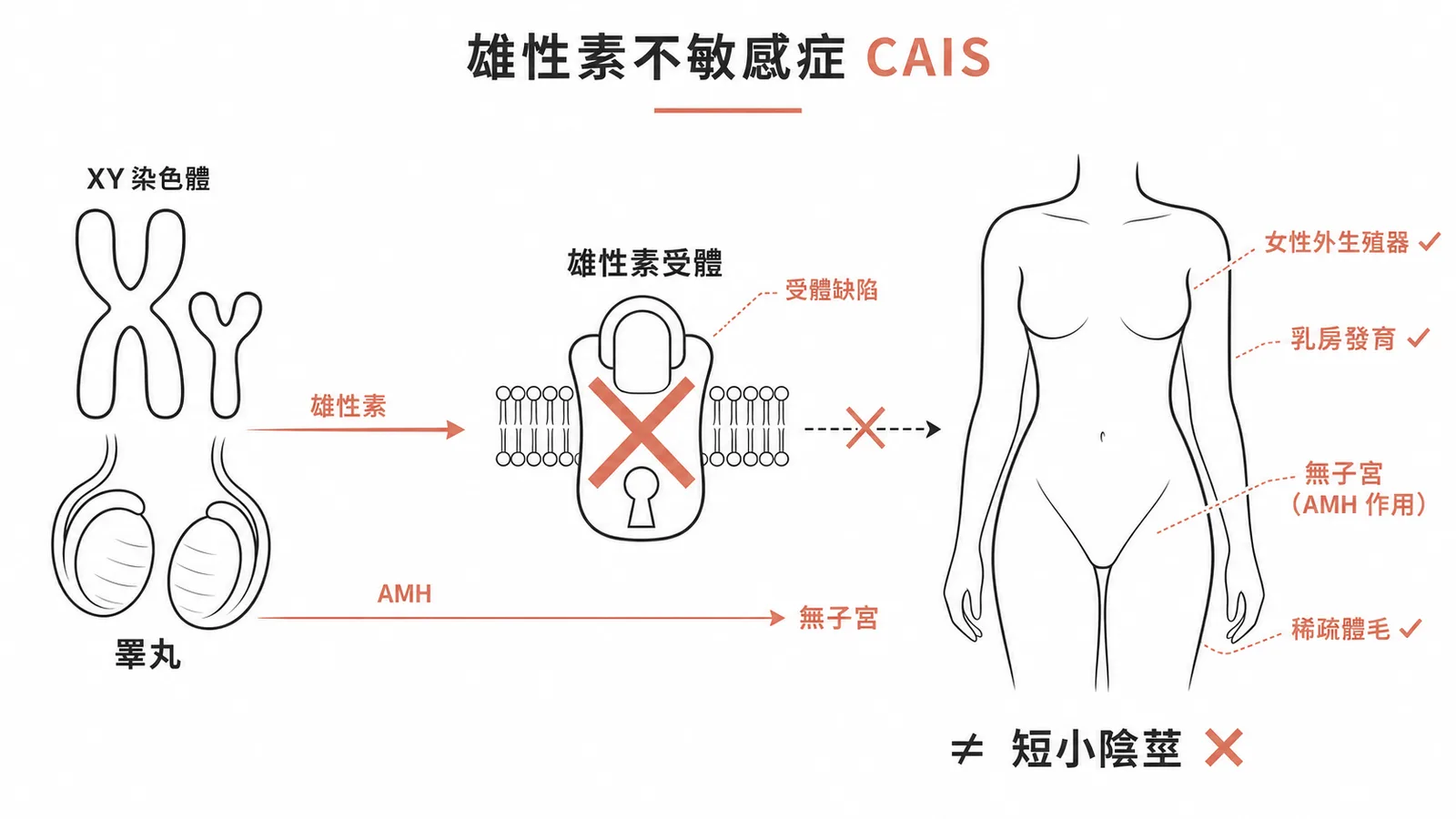 CAIS機轉：XY染色體但雄性素受體缺陷導致女性外觀無陰莖