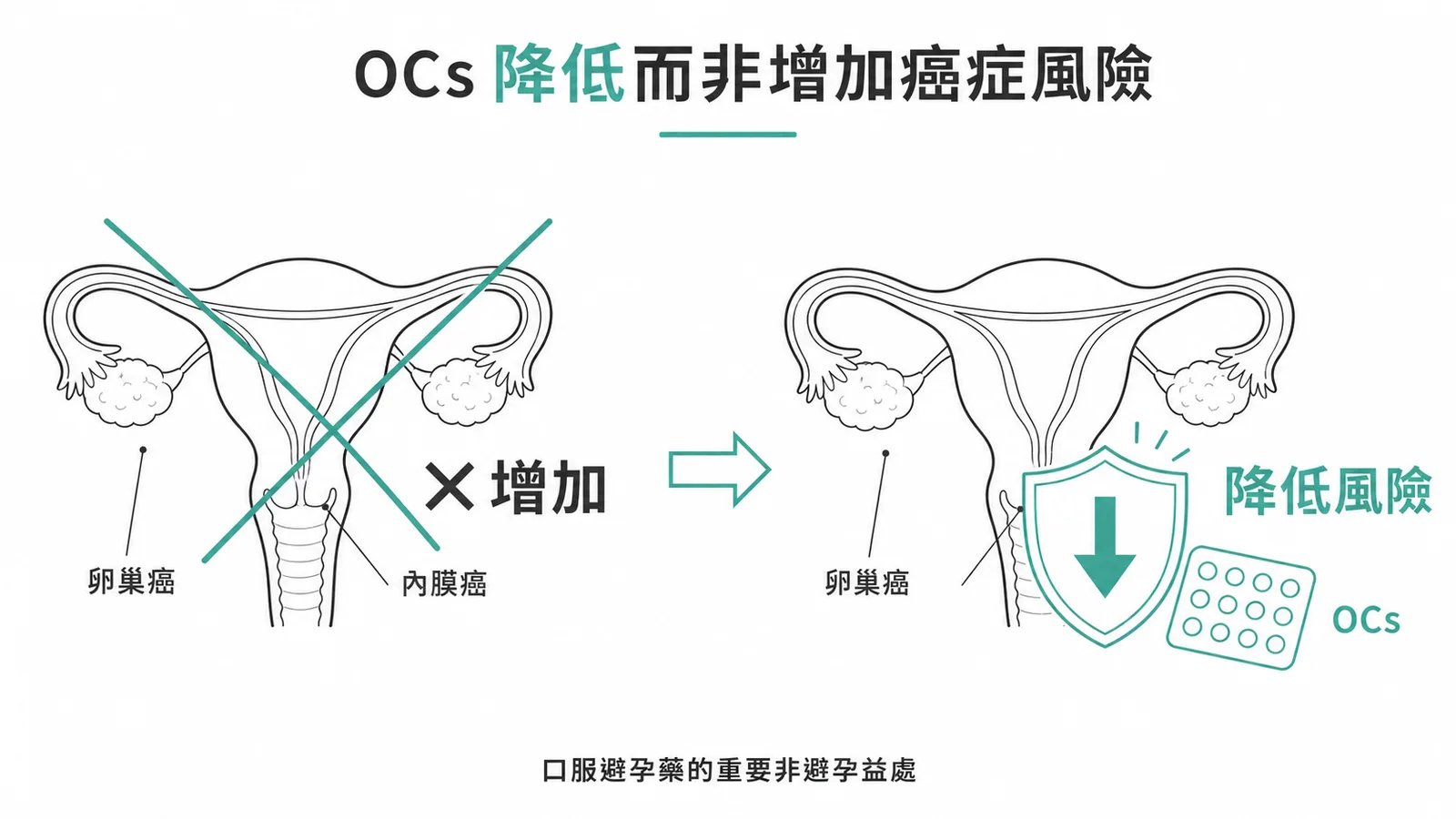 口服避孕藥降低而非增加卵巢癌與內膜癌風險