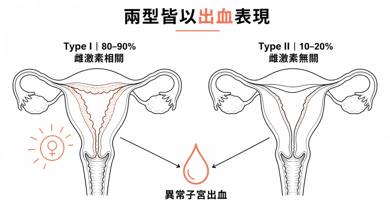 Type I 與 Type II 子宮內膜癌皆以異常子宮出血為主要表現