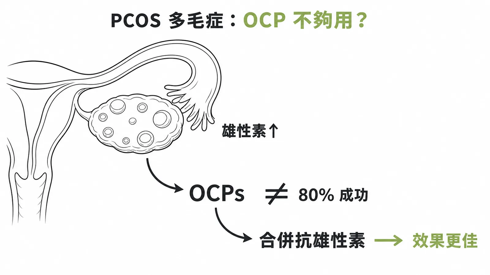 PCOS多毛症治療：口服避孕藥為基礎但常需合併抗雄性素