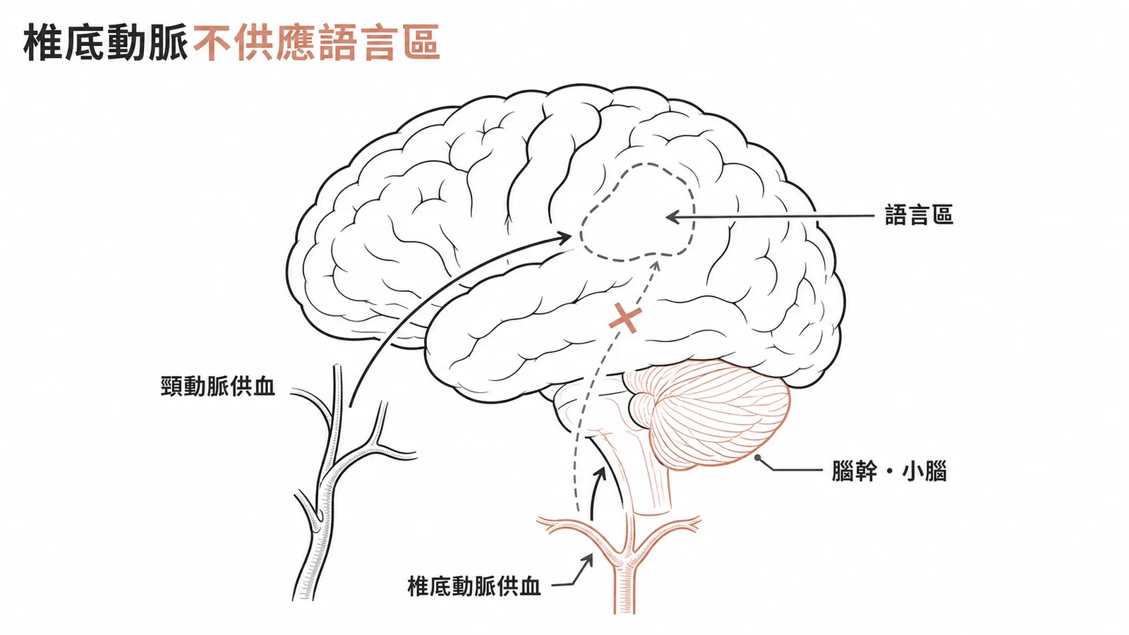 椎底動脈供血腦幹小腦但不供應大腦皮質語言區
