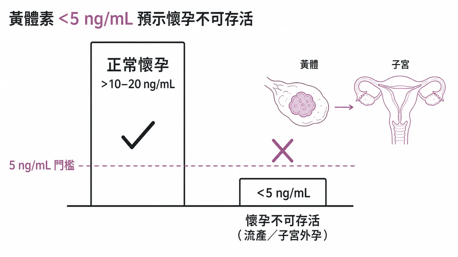 黃體素低於 5 ng/mL 預示懷孕不可存活