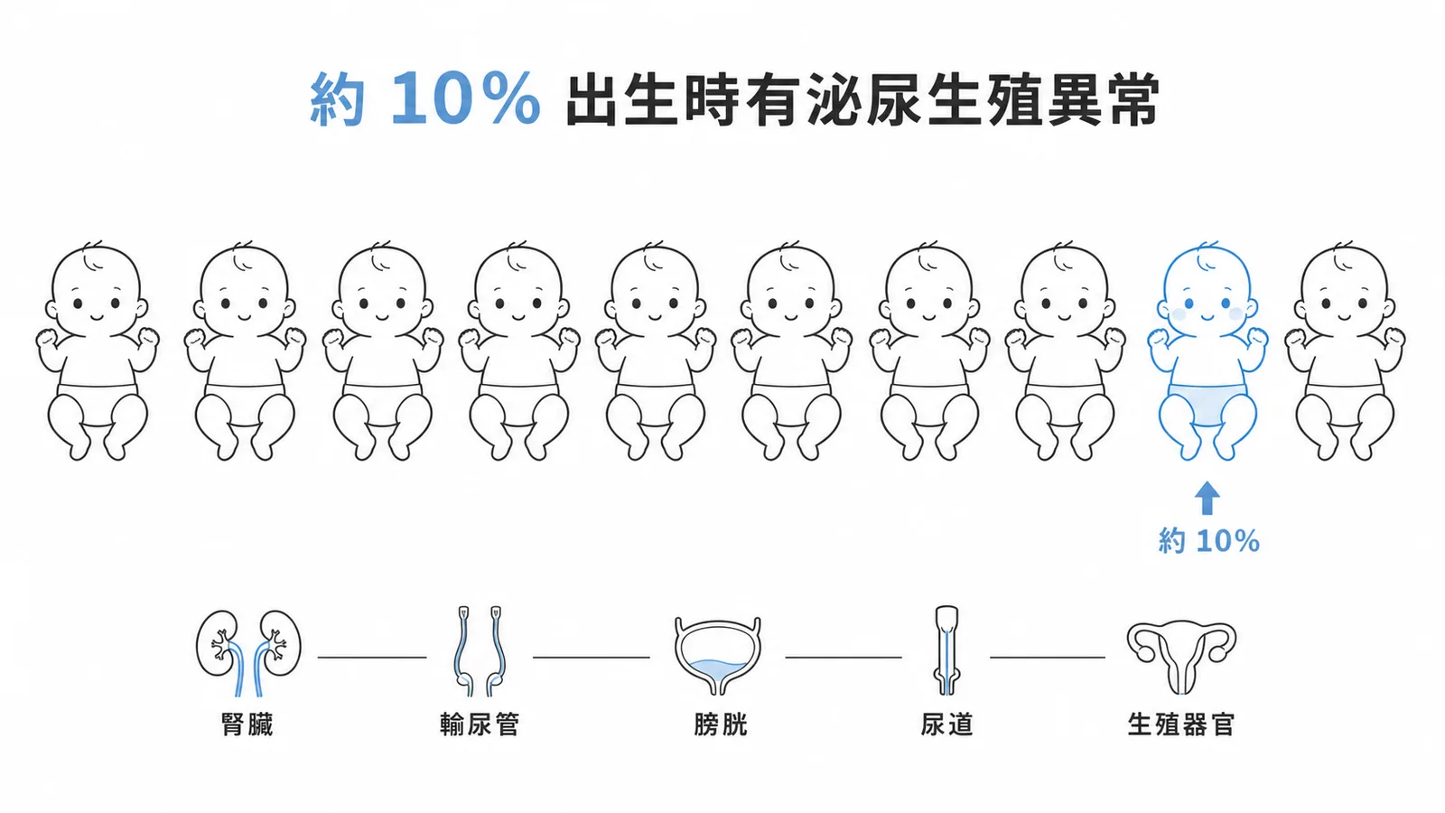 約10%嬰兒出生時有泌尿生殖系統異常的比例示意圖