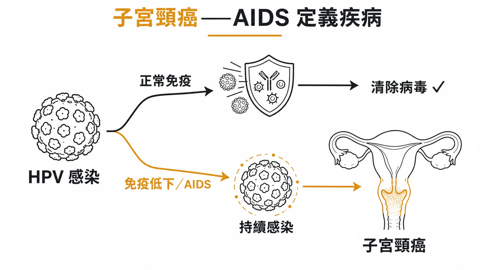 HPV感染在免疫正常與免疫低下時的不同轉歸:子宮頸癌為AIDS定義疾病