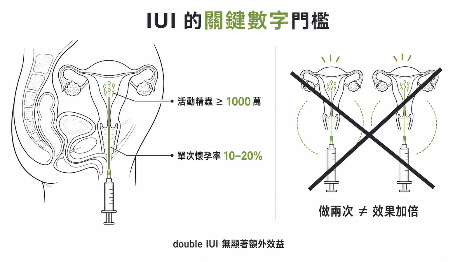 IUI關鍵數字:活動精蟲≥1000萬、單次懷孕率10-20%、double IUI無額外效益
